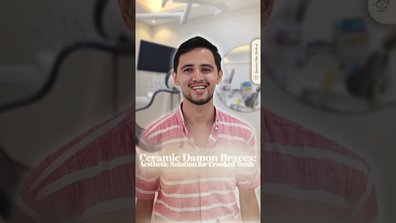Ceramic Damon Braces: Aesthetic Solution for Crooked Teeth