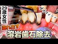 【29歳女性】溢れ出す溶岩歯石除去🌋🦷[29 year old female] overflowing lava tartar removal🌋🦷