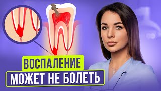 Как распознать есть ли у вас «киста» зуба (виды периодонтита)? | Что такое свищ и чем он опасен?