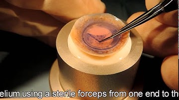 DMEK graft preparation by Stripping