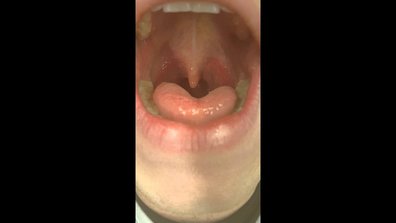 My Mouth And Uvula YouTube my-mouth-and-uvula-youtube