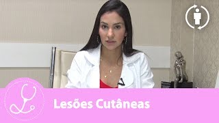 Cutânea erupção navalha std queimar ou
