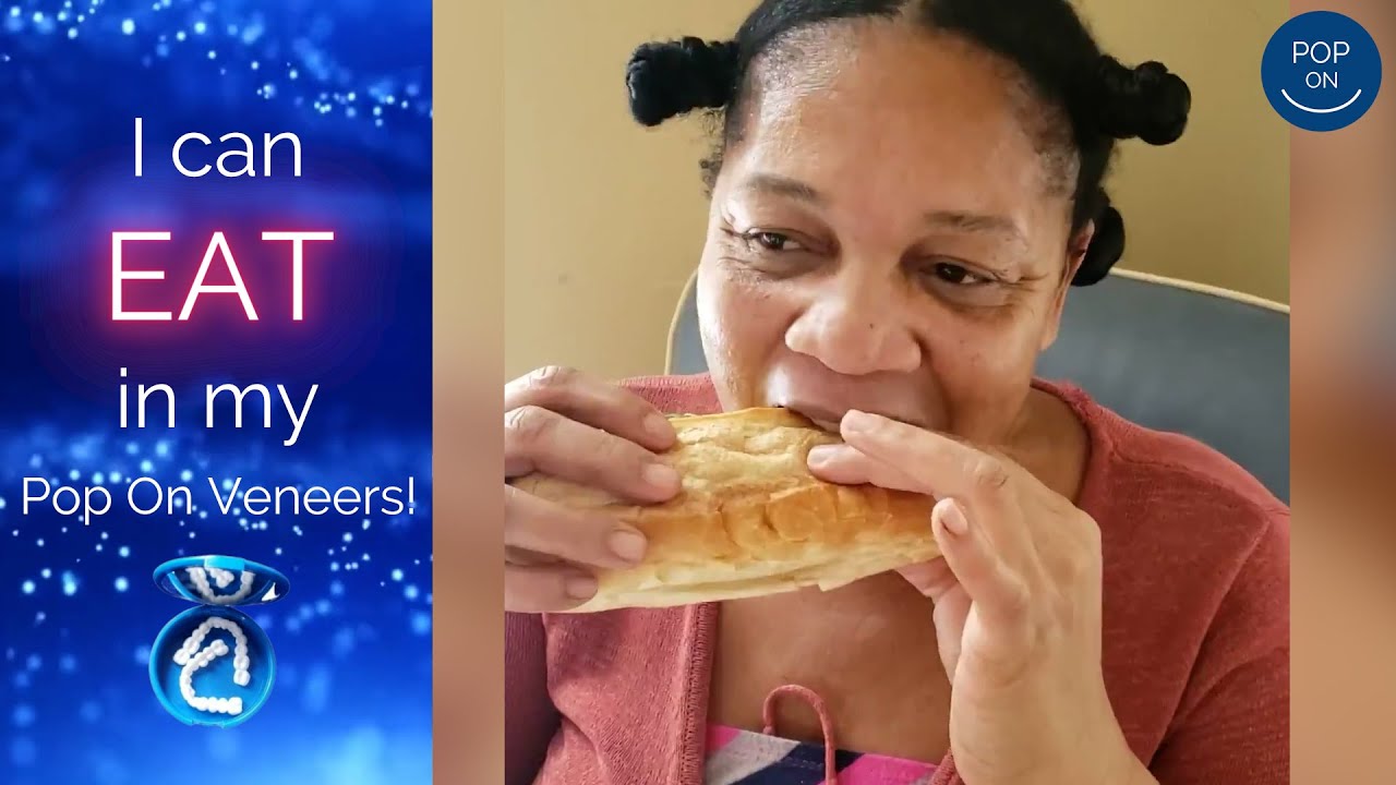 Eating with Pop On Veneers! 😋🍴 YouTube