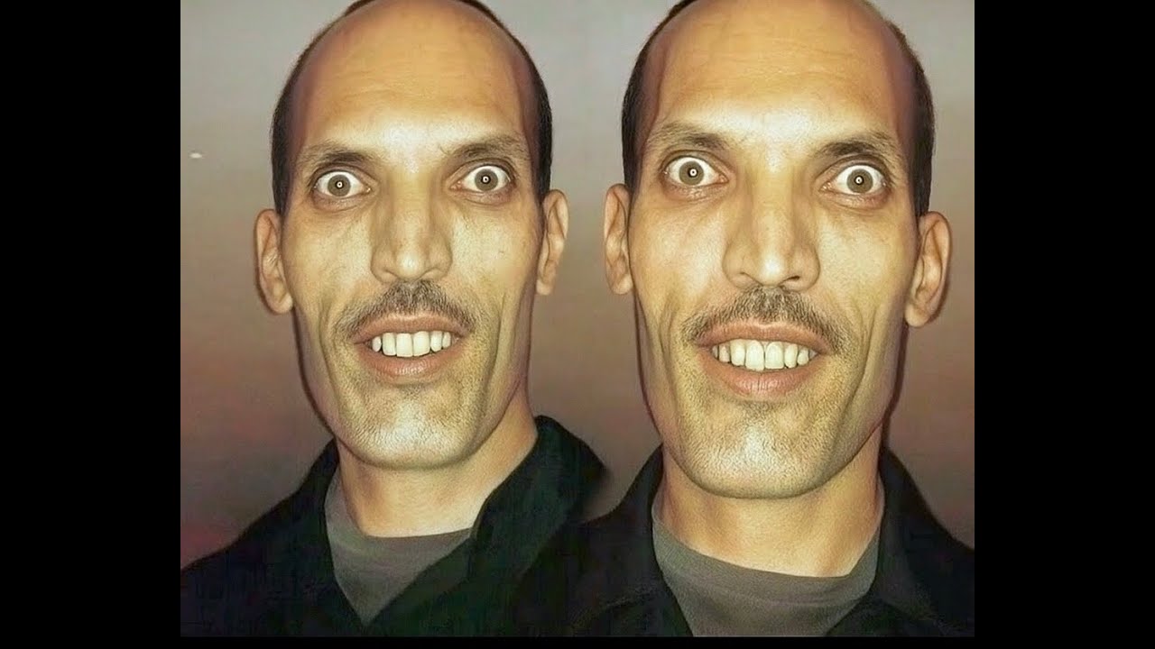 ALEX KARTELA - BLIZNACITE DISS