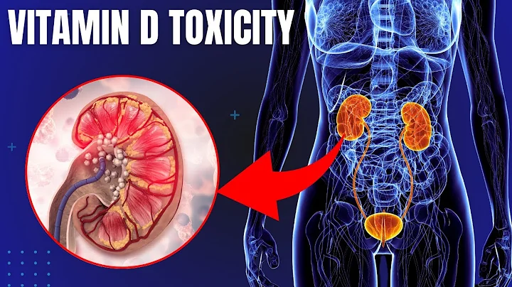 5 Warning Signs You Overdose on Vitamin D | Vitamin D Toxicity Symptoms