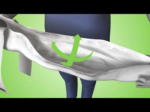 Tena Flex Fitting