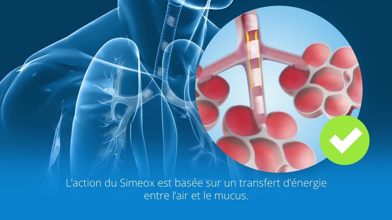 Découvrez la technologie Simeox, le dispositif médical de PhysioAssist !