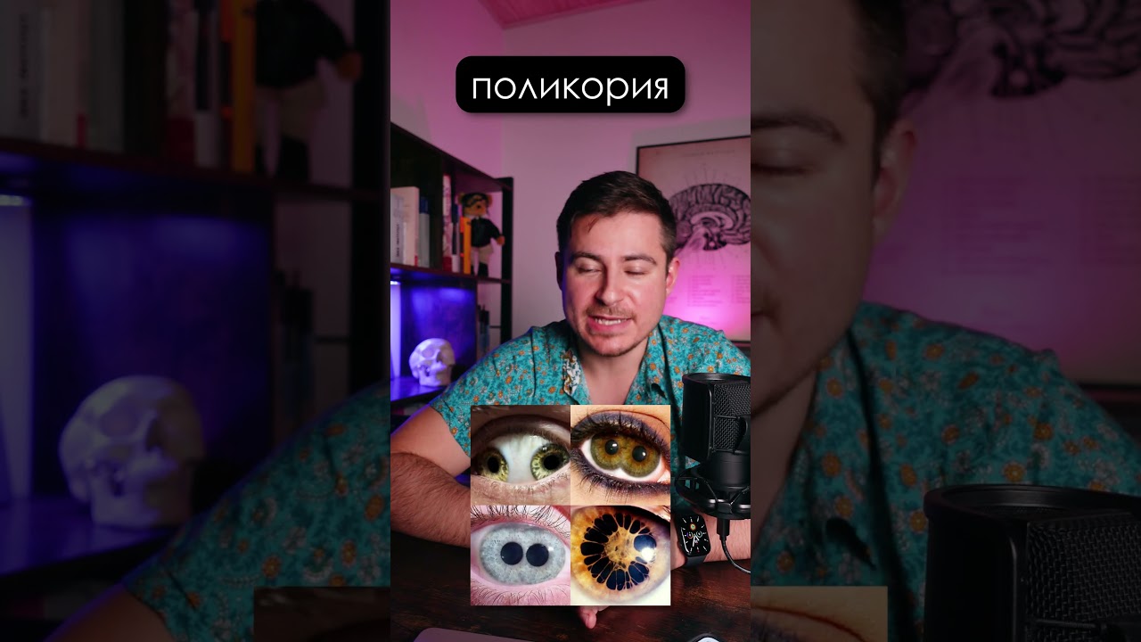 У меня 3 зрачка | Тайна моих глаз