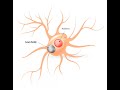 What is the correlation between Lewy bodies and Parkinson’s disease (PD)?