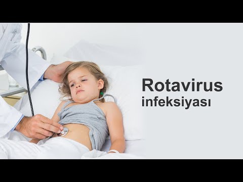 Rotavirus infeksiyası - Pediatr - Elşən Tağıyev