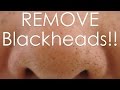 DIY how to REMOVE Blackheads Using an EGG!!