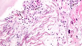 Hymenophore | Wikipedia audio article