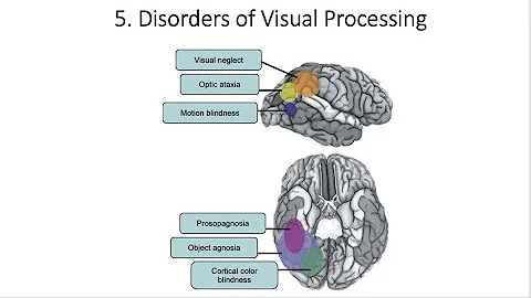 4.5. Disorders of Visual Processing, Fundamentals of Cognitive Neuroscience Course, Session 4, P 5