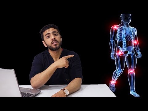 فيديو: كيف تعالج التهاب المفاصل؟