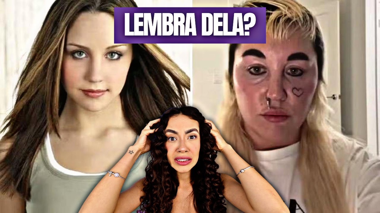 PERTURBADOR! VEJA COMO AMANDA BYNES DESTRUIU A APARÊNCIA! Cabelo e rosto irreconhecíveis!