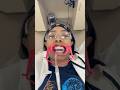 Come with me to get braces…again 😭 last time I swear! #braces #orthodontist #grwm #ootd #influencer