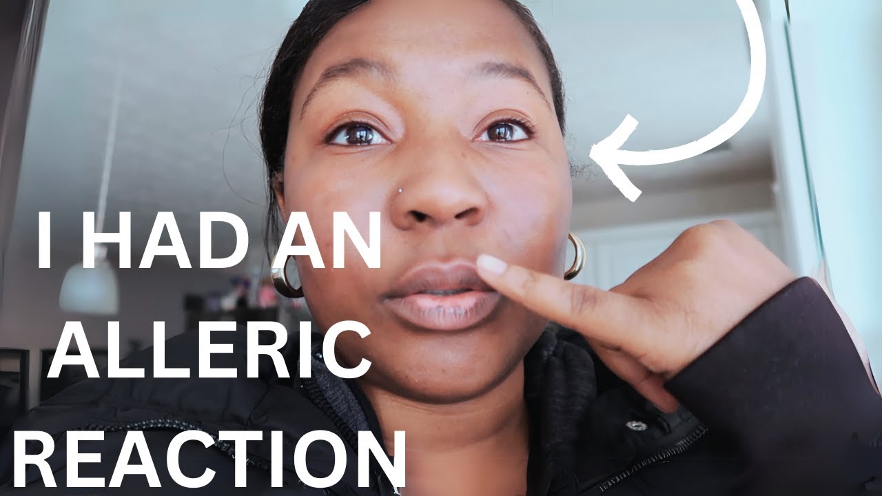 I HAD AN ALLERGIC REACTION from COSTCO FAMILY GROCERY SHOPPING YouTube