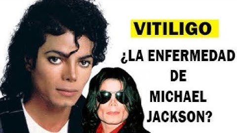 Vitiligo. ¿¿¿LA ENFERMEDAD DE MICHAEL JACKSON????