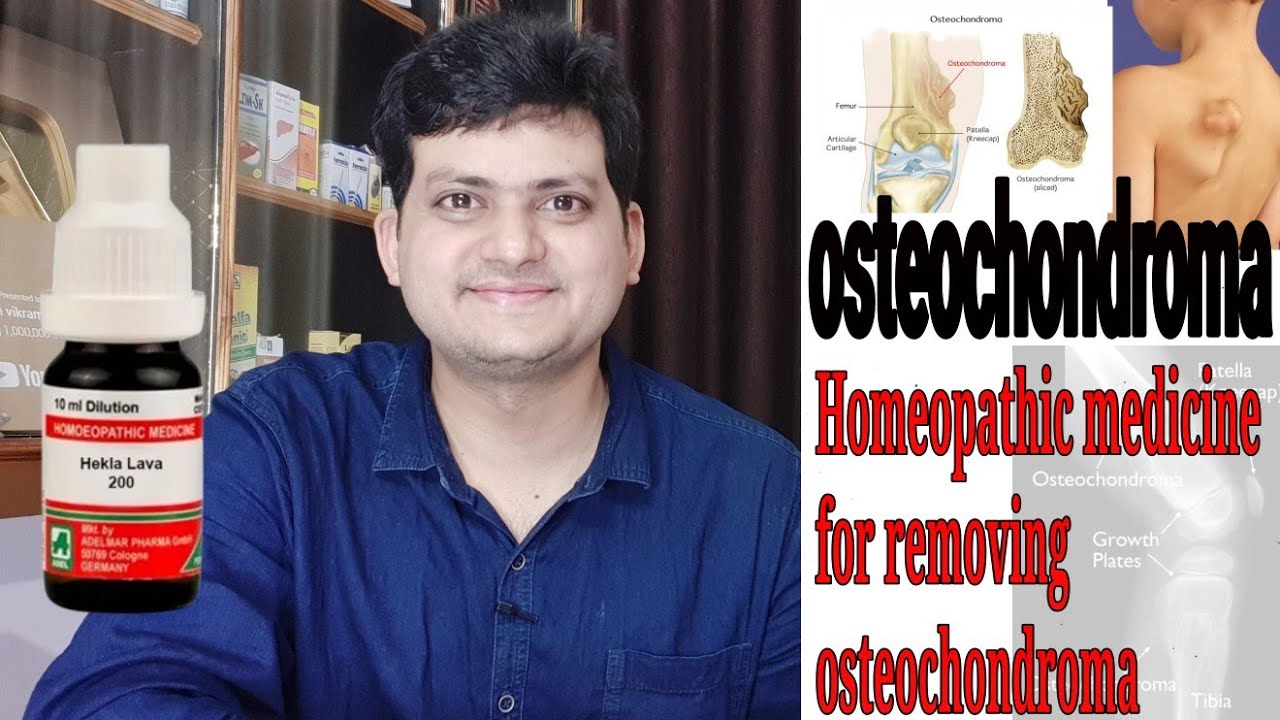 Homeopathic medicine for removing osteochondroma ? explain | bone tumor |