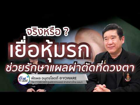 ชัวร์ก่อนแชร์ : เยื่อหุ้มรก ช่วยรักษาแผลผ่าตัดที่ดวงตาได้ จริงหรือ ?