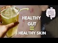 Gut Healthy Foods You Need in Your Acne Healing Journey