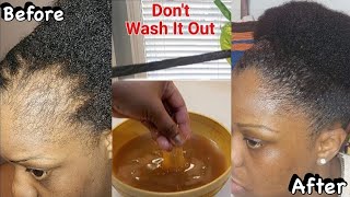 WOW Only 2 Ingredients to regrow frontline hair fast naturally | regrow hair on bald spot fast