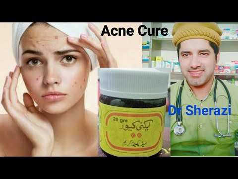 Acne Cure Cream ! Ance Pimples How To Cure Face Fleck Homeopathic Medicine and cream ?