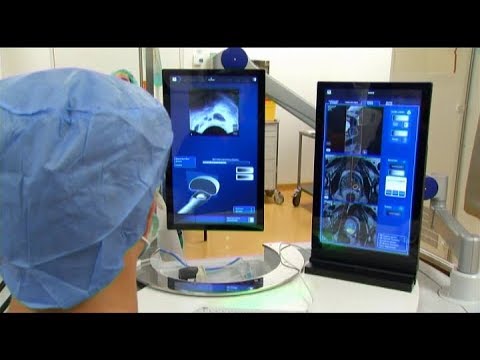 Video: Prostata-Ultraschall: Verfahren, Zweck, Ergebnisse Und Mehr