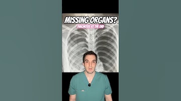 Missing organs on x-ray 🩻: organ donor saves many lives