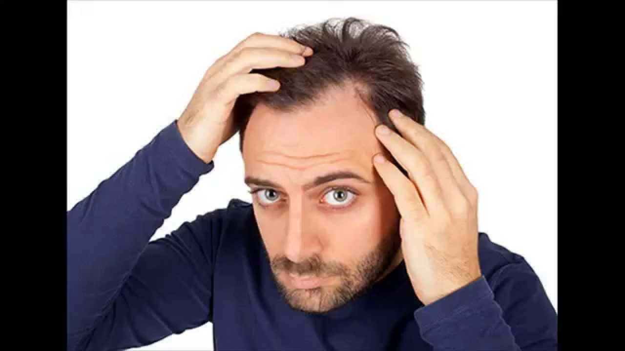 Hair Loss Treatment Reviews Consumer Reports YouTube