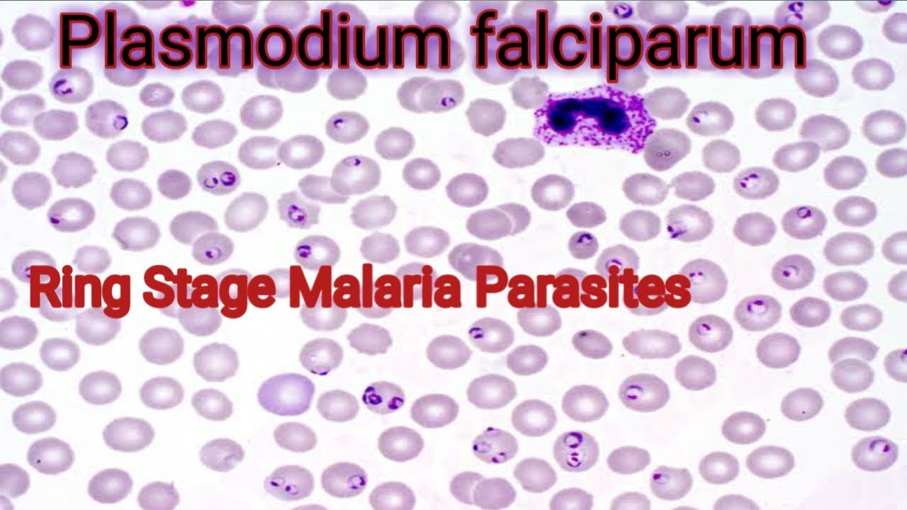 maláriás plazmodium schizonts