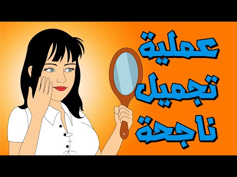 فيديو: عملية ناجحة