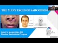 The Many Faces of Sarcoidosis