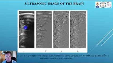 CMIS 2020 Application of the Fuzzy Clustering Technique for Processing and Analysis of Medical Image