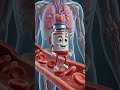 आयरन इंजेक्शन शरीर में कैसे काम करता है? | आसान हिंदी में समझें | Iron Injection Explained