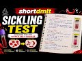 Sickling Test For Dmlt First Year In Hindi | Dmlt Exam 2026 Notes In Hindi| Hematology| Pathology|