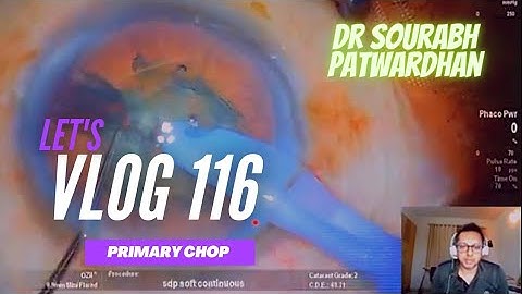 116 Vlog Primary chop in grade 2 cataract Dr Sourabh Patwardhan
