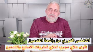 التخلص من رائحة القدمين | وفطريات الاظافر