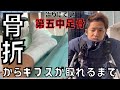 【骨折①】足の骨が折れました【治し方/リハビリ】