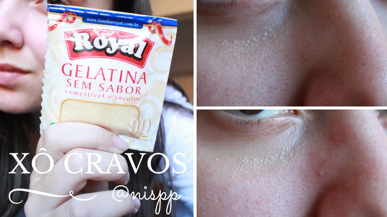 Como tirar cravos Máscara de gelatina barata e rápida [ANTES E DEPOIS