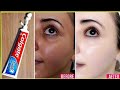 Apply Toothpaste on Your Skin and See Magical Result within 1 Hour । Amazing Toothpaste Beauty Hacks