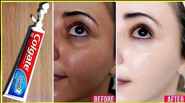 Does toothpaste make skin whiter?