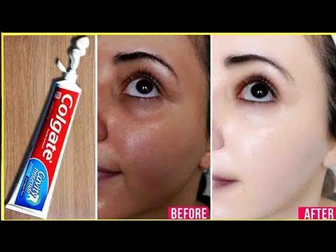 apply-toothpaste-on-your-skin-and-see-magical-result-within-1-hour-।-amazing-toothpaste-beauty-hacks