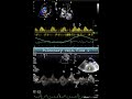 Pulmonary vein flow 1