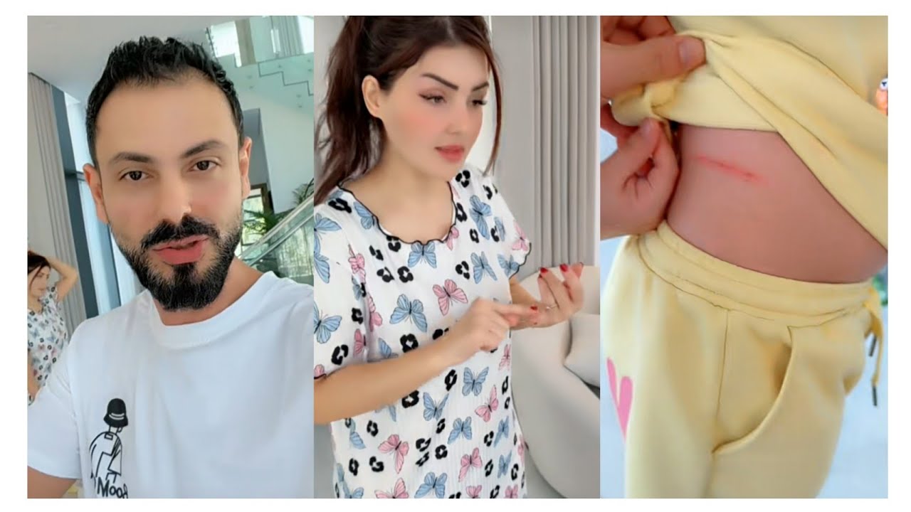 نور وعصام صار مشكلة معنا قط خرمشت ماري 😱نور قرارنا نجيب مرجوح 