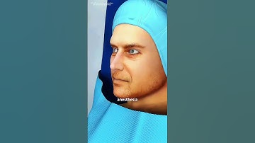 How Circumcision Surgery Is Performed (3D animation) #music #motivation #epic #like