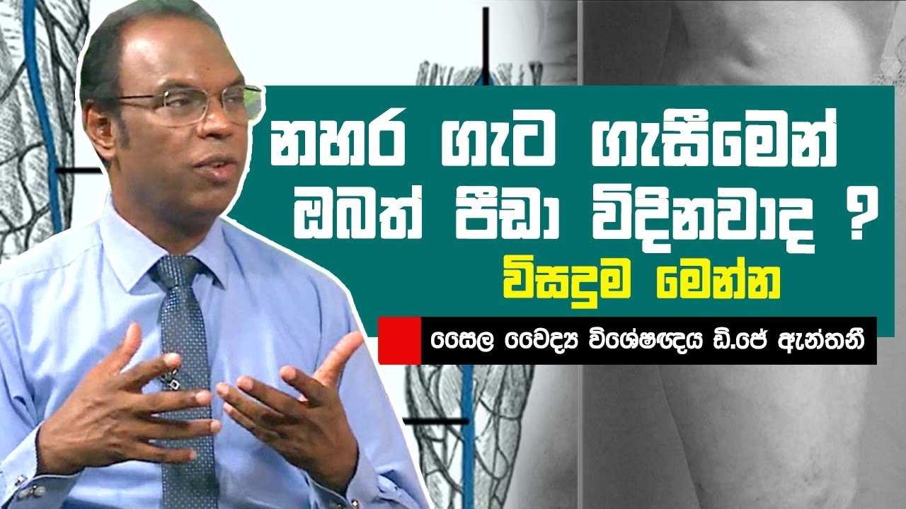 නහර ගැට ගැසීමෙන් ඔබත් පීඩා විදිනවාද ? විසදුම මෙන්න | Piyum Vila | 14 - 05 - 2019 | Siyatha TV