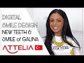 Digital smile makeover for galina from bulgaria