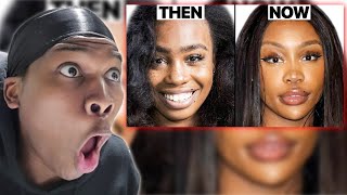 SZA EXPOSED FOR GETTING PLASTIC SURGERY???