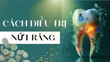 Cách điều trị nứt răng | Tt Niềng Răng quốc tế Diamond